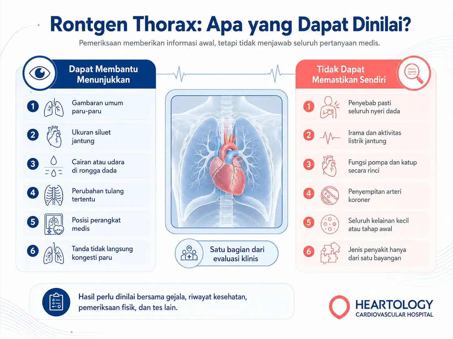 Infografik kemampuan dan keterbatasan rontgen thorax dalam menilai paru-paru, siluet jantung, rongga dada, tulang, dan posisi perangkat medis.