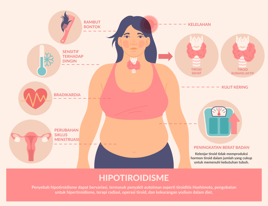Heartology cardiovascular hospital infografis penyakit tiroid hipotiroidisme