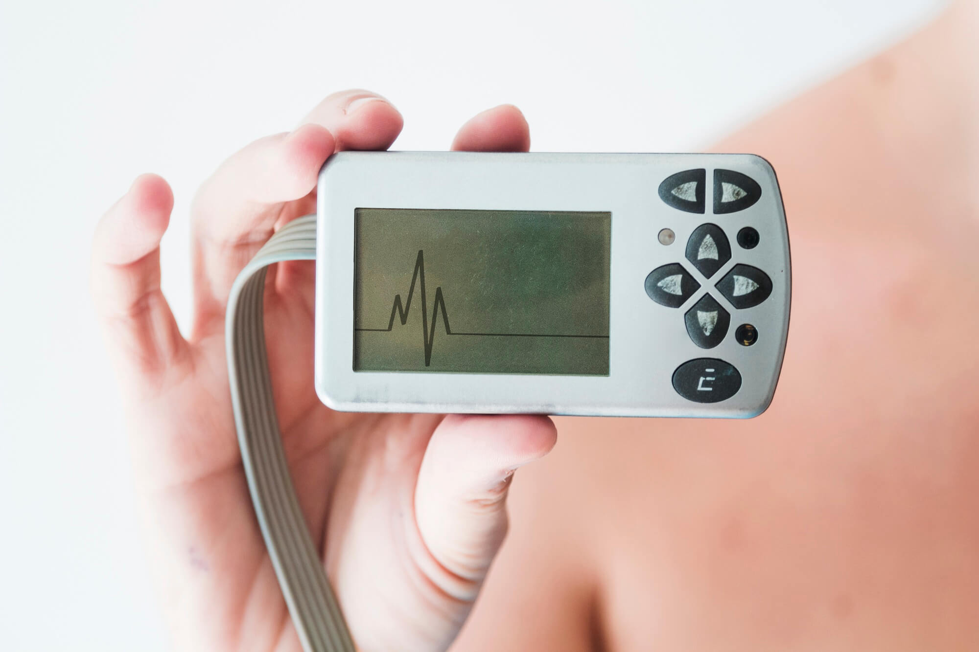Perangkat Holter Monitor