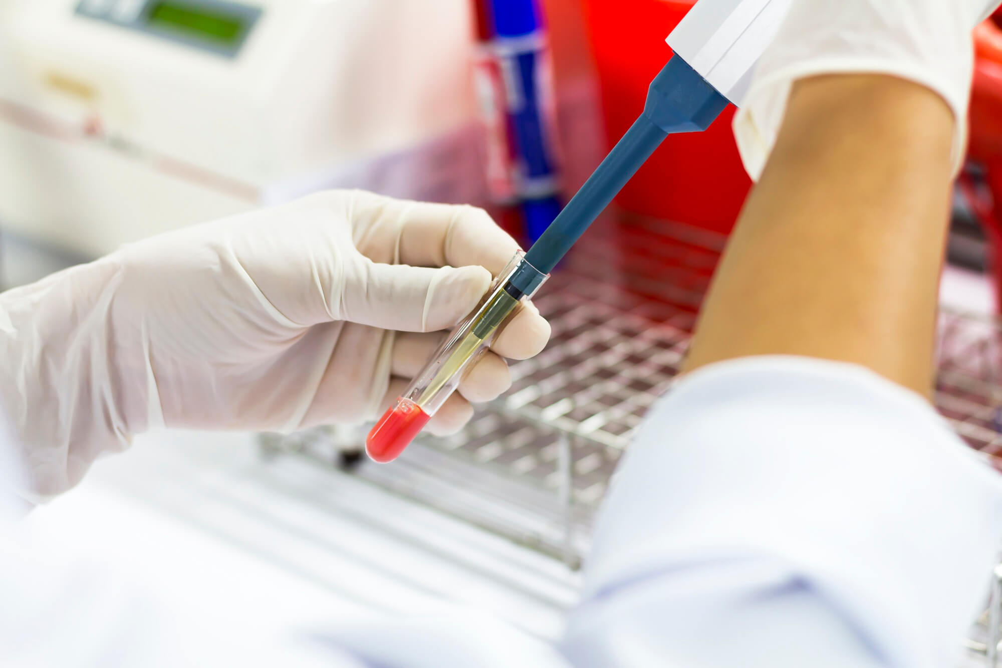 Gloved hand of a laboratory worker using a pipette on a blood sample tube