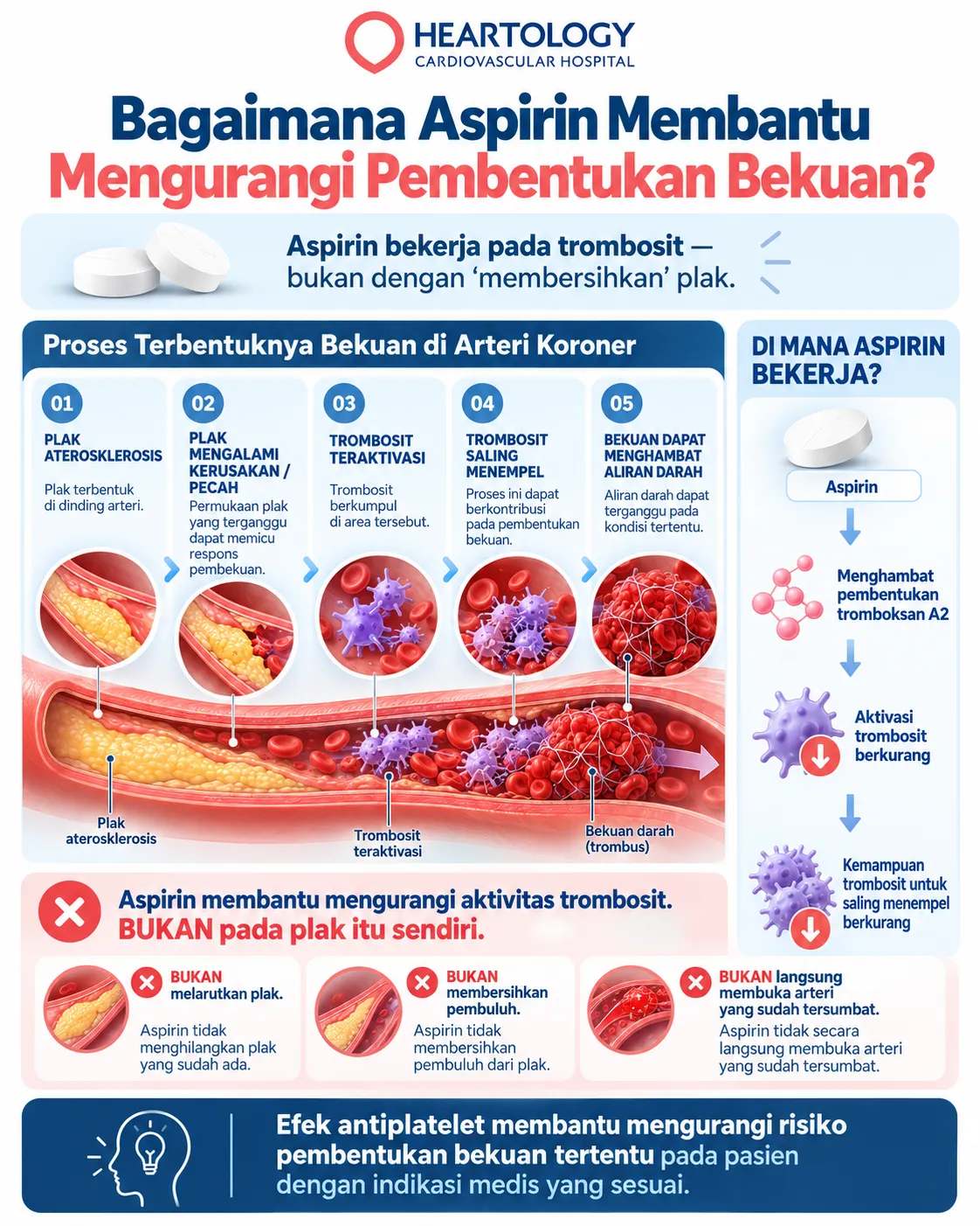 Infografis mekanisme aspirin yang menunjukkan plak aterosklerosis, aktivasi dan agregasi trombosit, pembentukan bekuan, serta cara aspirin mengurangi aktivitas trombosit.