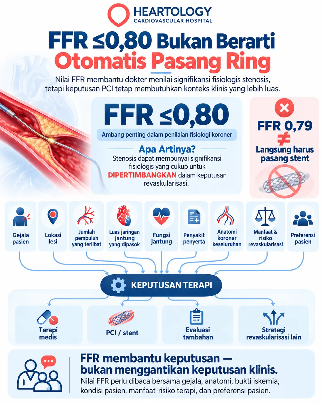 Infografik medis Heartology tentang FFR ≤0,80 bukan berarti otomatis pasang ring, menampilkan bahwa hasil FFR adalah salah satu faktor dalam keputusan terapi penyakit jantung koroner bersama gejala pasien, lokasi lesi, jumlah pembuluh yang terlibat, fungsi jantung, anatomi koroner, penyakit penyerta, manfaat-risiko revaskularisasi, dan preferensi pasien.