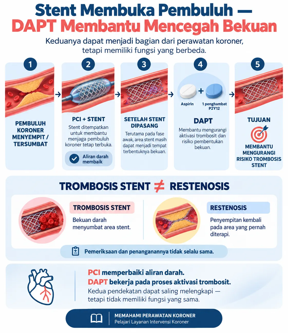 Infografis Heartology tentang peran stent dan DAPT setelah PCI, termasuk perbedaan trombosis stent dan restenosis serta fungsi antiplatelet dalam mengurangi risiko pembentukan bekuan.