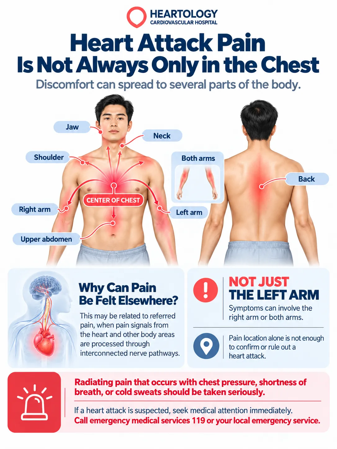 Heartology medical infographic showing where heart attack pain can radiate, including the chest, shoulders, left and right arms, jaw, neck, back, and upper abdomen, with labeled body illustrations and emergency guidance.