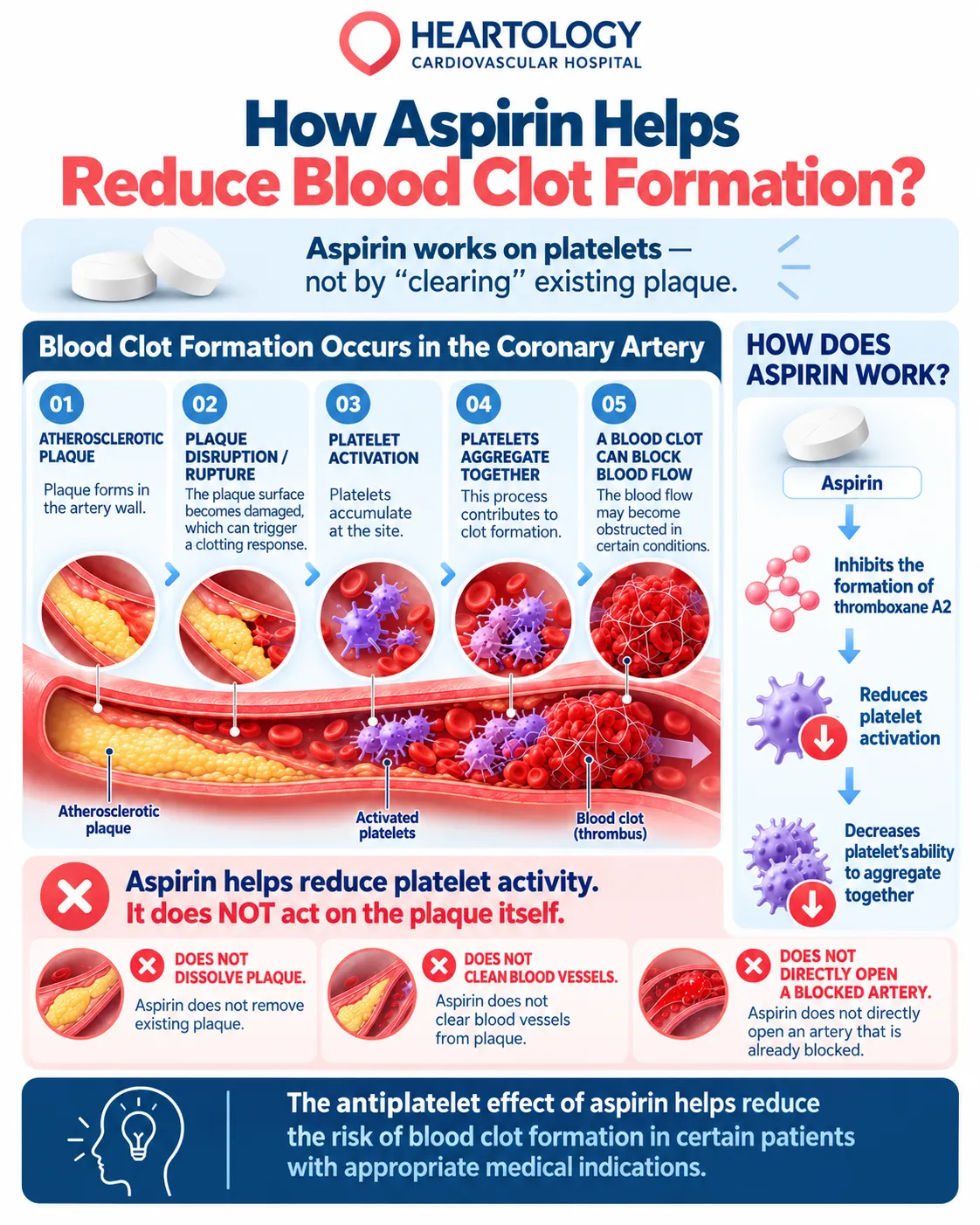 Infographic showing atherosclerotic plaque, platelet activation and aggregation, clot formation, and how aspirin reduces platelet activity.
