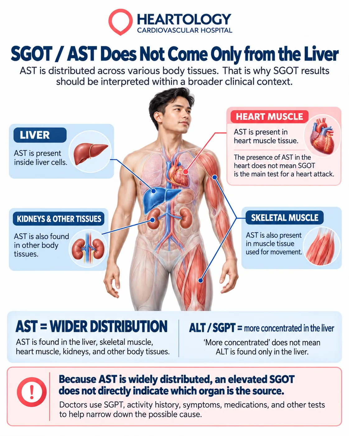 Medical infographic illustrating where SGOT (AST) is found in the body, including the liver, heart muscle, skeletal muscle, and kidneys, and explaining why elevated AST levels do not necessarily indicate liver disease.